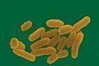 在病灶標本中 圖2。鼠疫桿菌Yersing pestis（圖片來源：搜狗百科[2]）